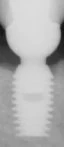 HA Coated (3.0)