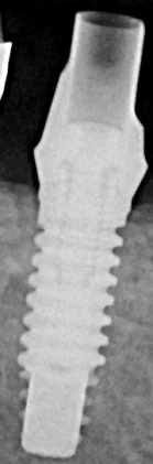 External (4.2)