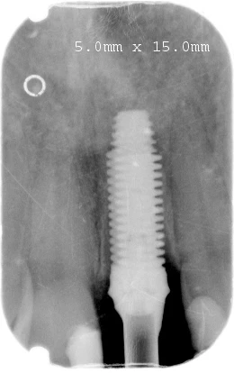 External (5.2)
