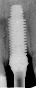 External (5.2)