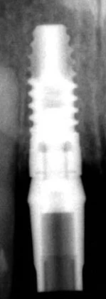 Internal (3.5)