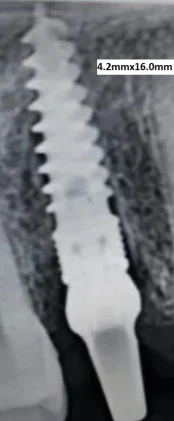 Grip (3.5)