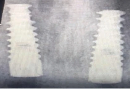 SDI Spiral Implant (3.5)