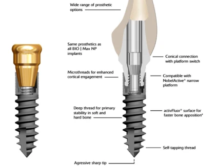 Max NP mini 3.0mm (3.5)