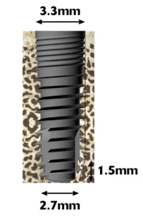 Quattro 3.3mm Narrow