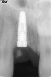 Root Line (3.8)