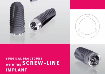 Screw Line (3.3)
