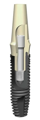 PerioType X-Pert