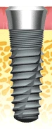 Atlas Internal Taper (5.9)