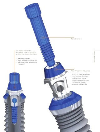 TSA Advance S3 (3.7)