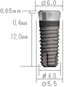 Internal
