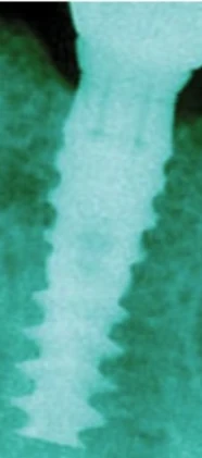 Ultimate ULT