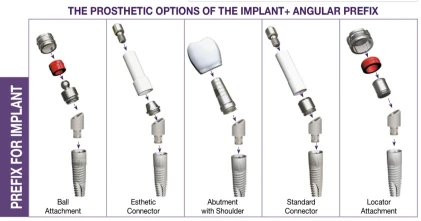 Prima Titanium Implant (PRTI) 2.43