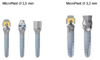 Microplant