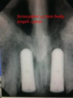 ScrewPlant (4.7)