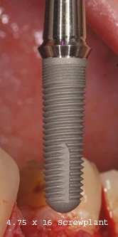 ScrewPlant (4.7)