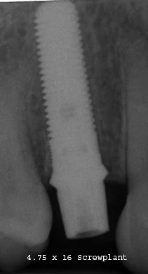 ScrewPlant (4.7)