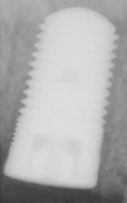 ScrewPlant (5.7)