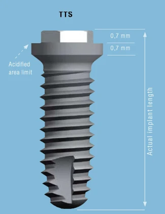 Cylindrical Implus None Polished Neck External Hex TTS (4.1)