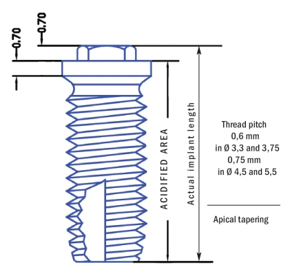 Cylindrical Implus Polished Neck External Hex (4.1)
