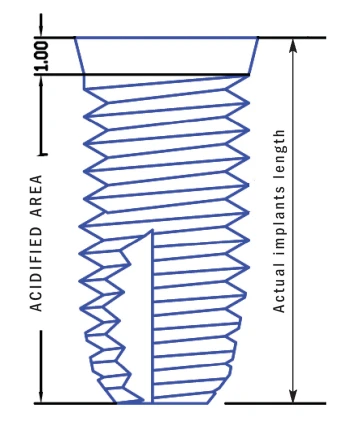 Cylindrical Implus Polished Neck Internal Hex (6.0)