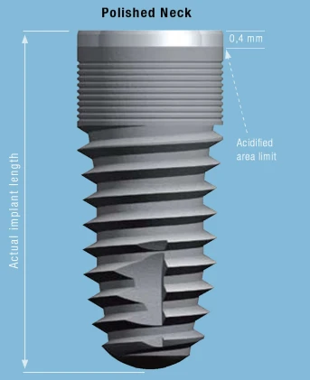 Cylindrical Implus Polished Neck Internal Hex (4.0)