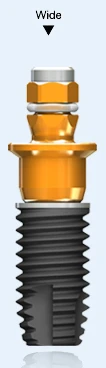 ExFeel External Hex Wide (5.0)