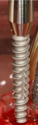 S-Mini Cemented Type
