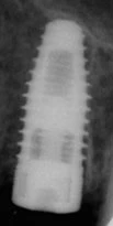 Nobel Replace -Taper RP (4.3)