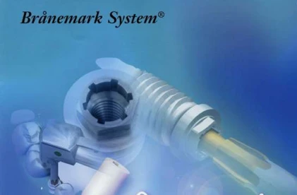 Branemark System MK III-regular platform (4.1)