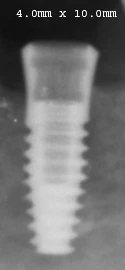 TSI (4.0)