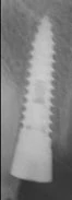 Maxi Z (3.75)