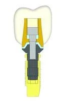 Physioplant Linea XL (5.0)