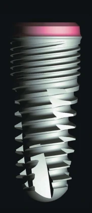 Smiler Sub-Cone (6.5)
