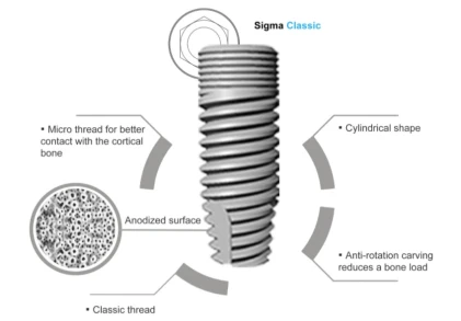 Sigma Classic
