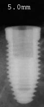Tri-Nex IA-L-50