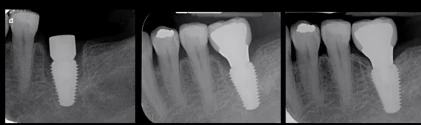Max 7 (5.0)