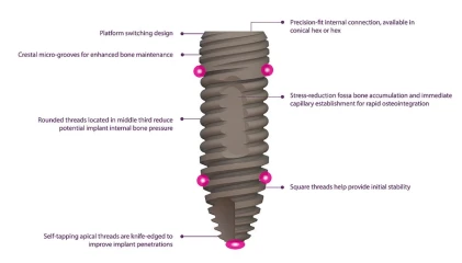 ESI-Essential Spectrum Implant-Conical Hex Connection NP (3.5)
