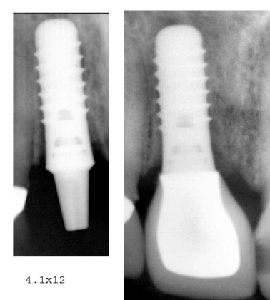 Standard (RN)