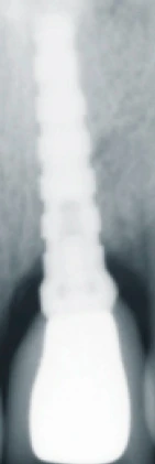 Anatomic (AN)