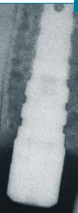 Anatomic (AW)
