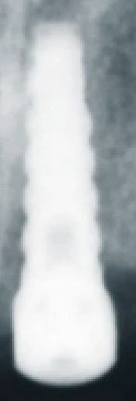Anatomic (P)