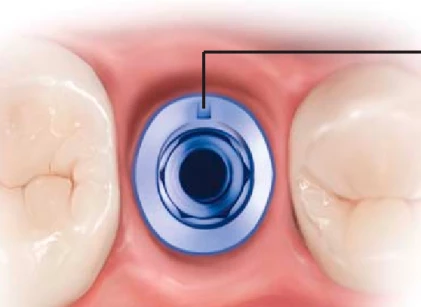 Anatomic (P)