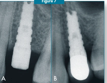 Anatomic (AW)
