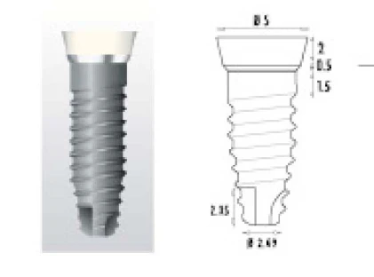 Z1 Conic (5.0)