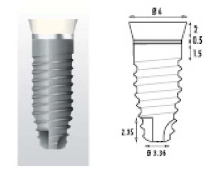 Z1 Conic (6.0)