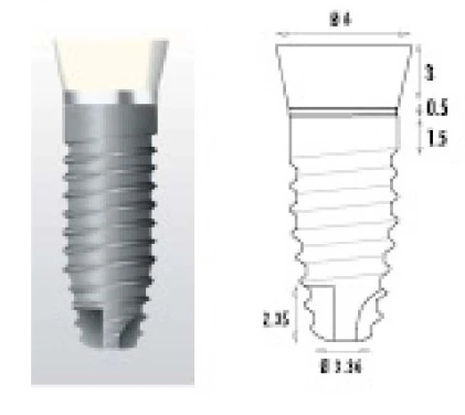 Z1 Conic (6.0)