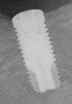 Cylindrical Large