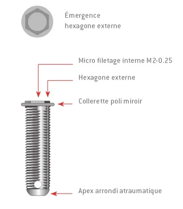 Structure S
