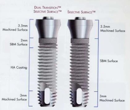 Screw-Vent Complete (4.5) (Paragon)